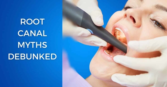 Root Canal Myths Debunked text with photo of lady having her mouth examined