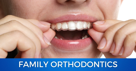 Close up of a smile and adult with aligners