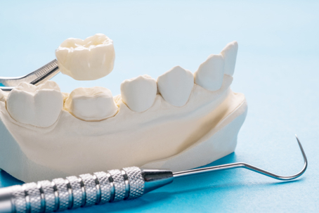 Prosthodontic