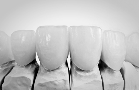 Graphic of Teeth Restoration